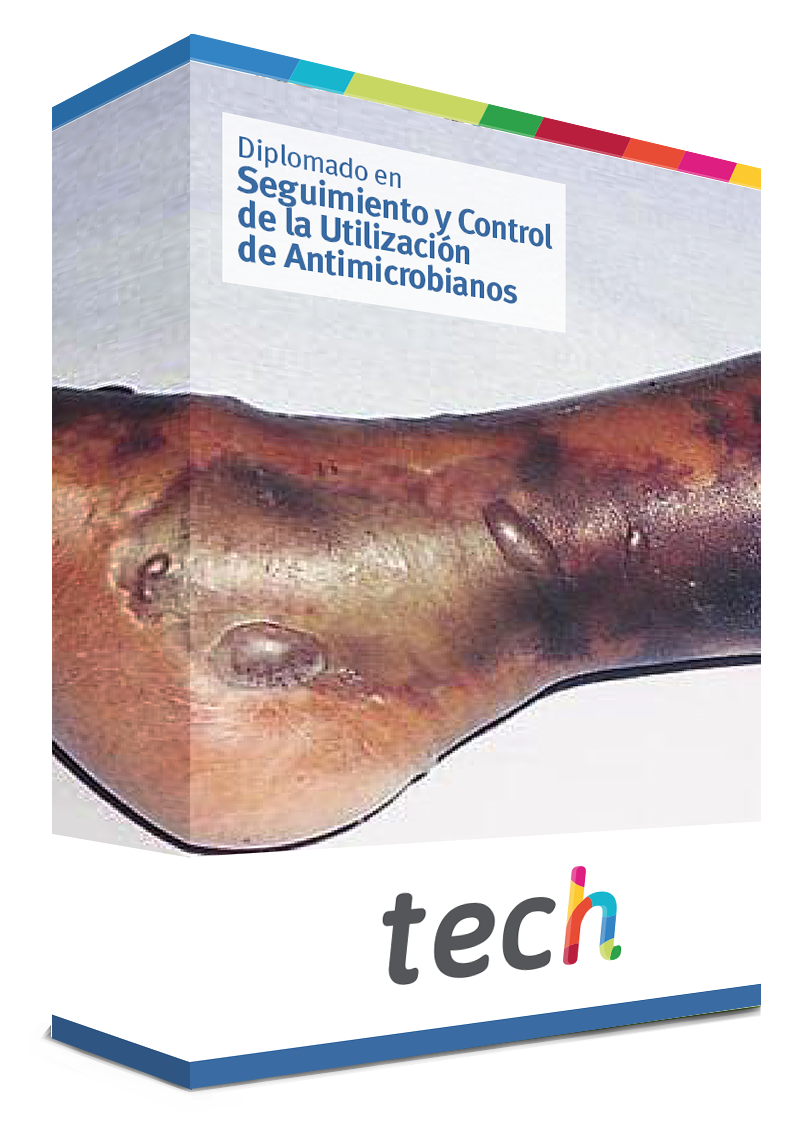 diplomado seguimiento control utilizacion antimicrobianos caja