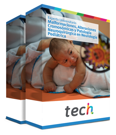 especializacion malformaciones alteraciones cromosomicas patologia neuroquirurgica neurologia pediatrica caja