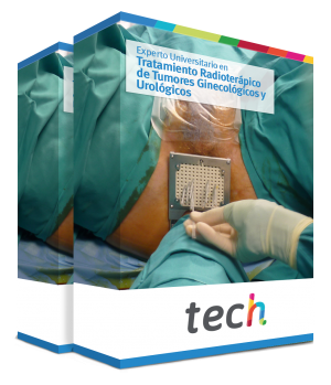 especializacion tratamiento radioterapico tumores ginecologicos urologicos caja