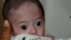 ##IMAGE##