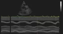 formacion imagen ecográfica