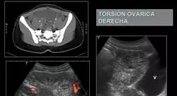 posgrado imagen ecográfica