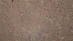 ##IMAGE##