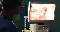 diplomado online cirugía histeroscópica