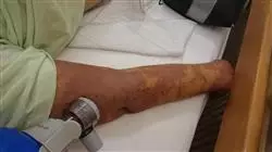 ##IMAGE##