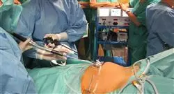 curso cirugía ultra mini invasiva y robótica en ginecología