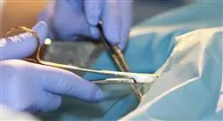 curso online cirugía ultra mini invasiva y robótica en ginecología