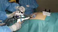 curso cirugía endoscópica en oncología ginecológica