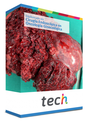 diplomado cirugia endoscopica oncologia ginecologia caja