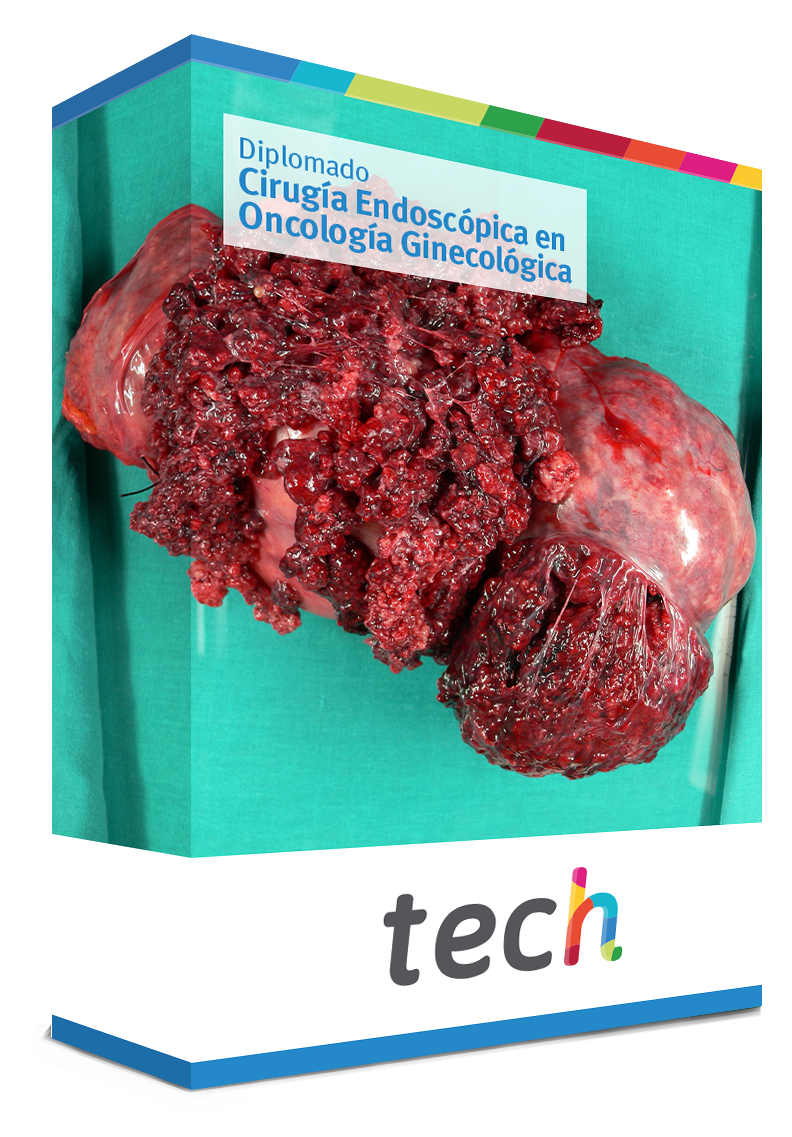 diplomado cirugia endoscopica oncologia ginecologica caja