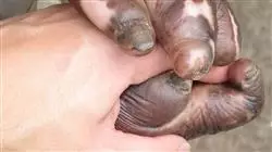 ##IMAGE##