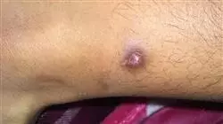 ##IMAGE##
