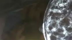 ##IMAGE##