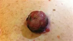 ##IMAGE##