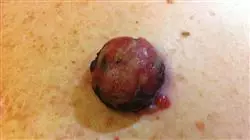 ##IMAGE##