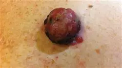 ##IMAGE##