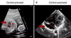 posgrado imagen cardíaca no invasiva y pruebas funcionales en cardiología pediátrica