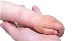 ##IMAGE##