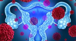 posgrado tumores genito urinarios