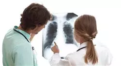curso tratamiento del carcinoma microcítico de pulmón y otros tumores torácicos