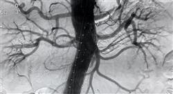 formacion ecografía clínica vascular
