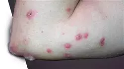 ##IMAGE##