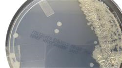 especializacion online infecciones micobacterias tuberculosas