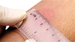 ##IMAGE##