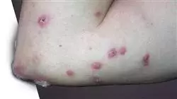 ##IMAGE##