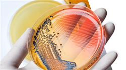 formacion infecciones micobacterias tuberculosas