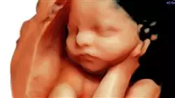 ##IMAGE##