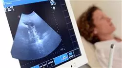 ##IMAGE##