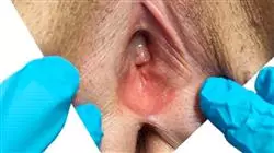 ##IMAGE##