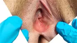 ##IMAGE##