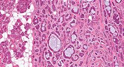 curso tumores de cabeza y cuello