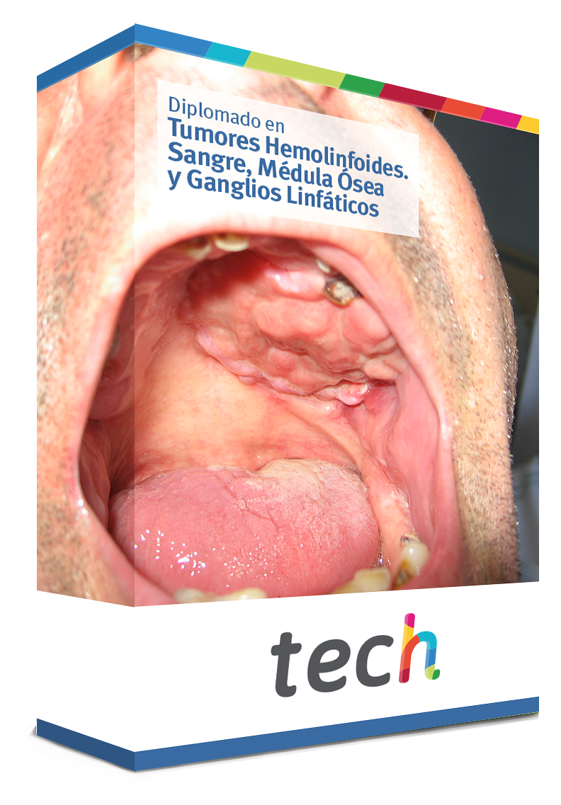 diplomado tumores hemolinfoides sangre medula osea ganglios linfaticos caja