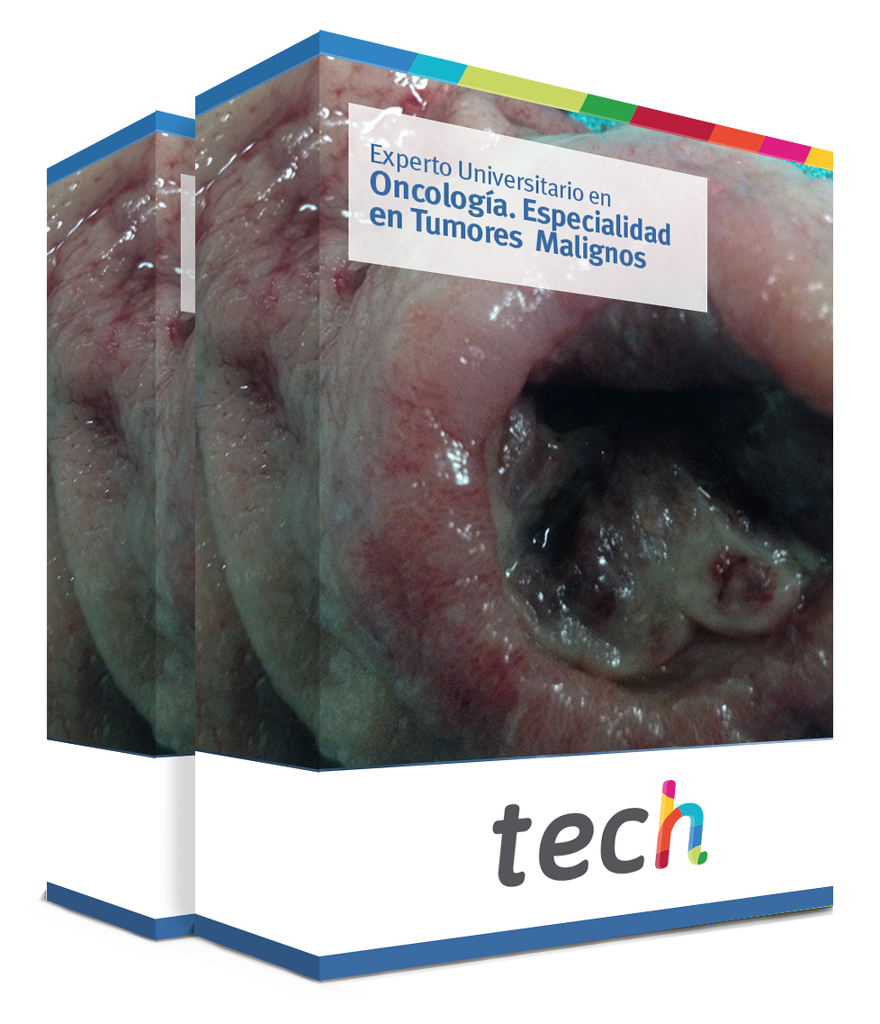 especializacion oncologia especialidad tumores malignos caja