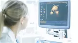 cursos ecografia gestacion multiple ecocardiografia neurosonografia fetal