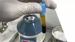 ##IMAGE##