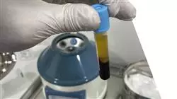 ##IMAGE##