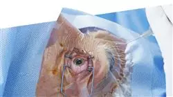 ##IMAGE##
