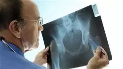 ##IMAGE##