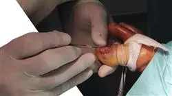 cursos cirugia mayor ambulatoria