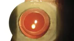 ##IMAGE##