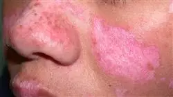 ##IMAGE##