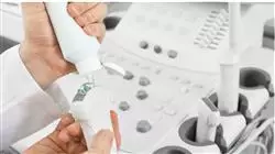 ##IMAGE##
