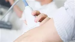 ##IMAGE##