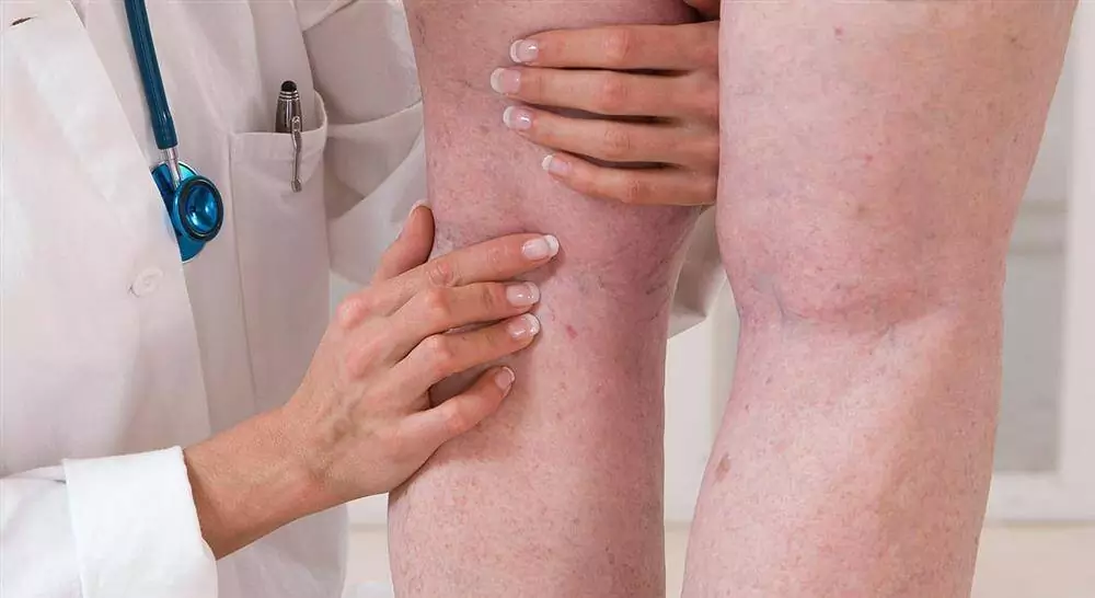 especializacion online atención a patologías agudas para médicos generales