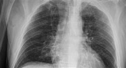 diplomado online ecografía clínica en urgencias y emergencias de atención primaria