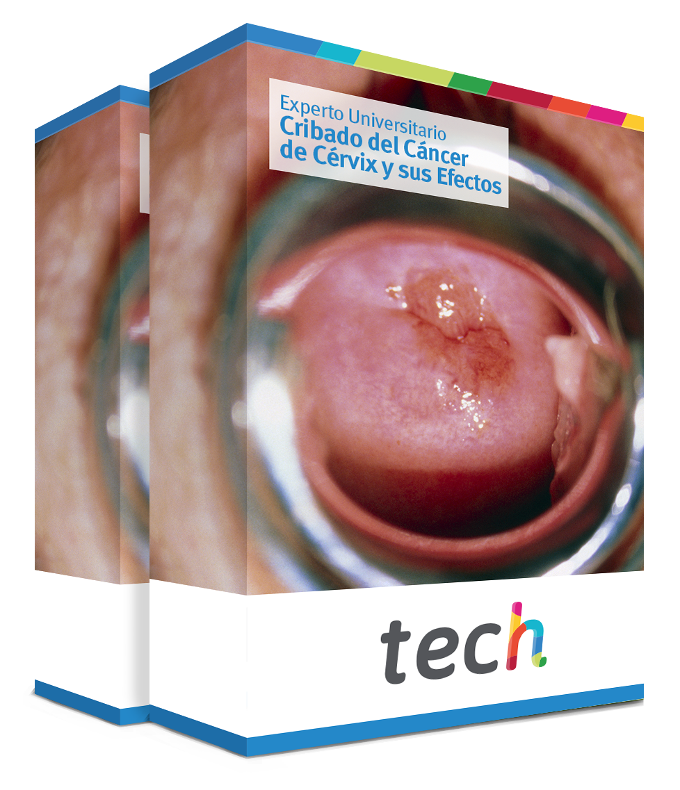 especializacion cribado cancer cervix efectos caja